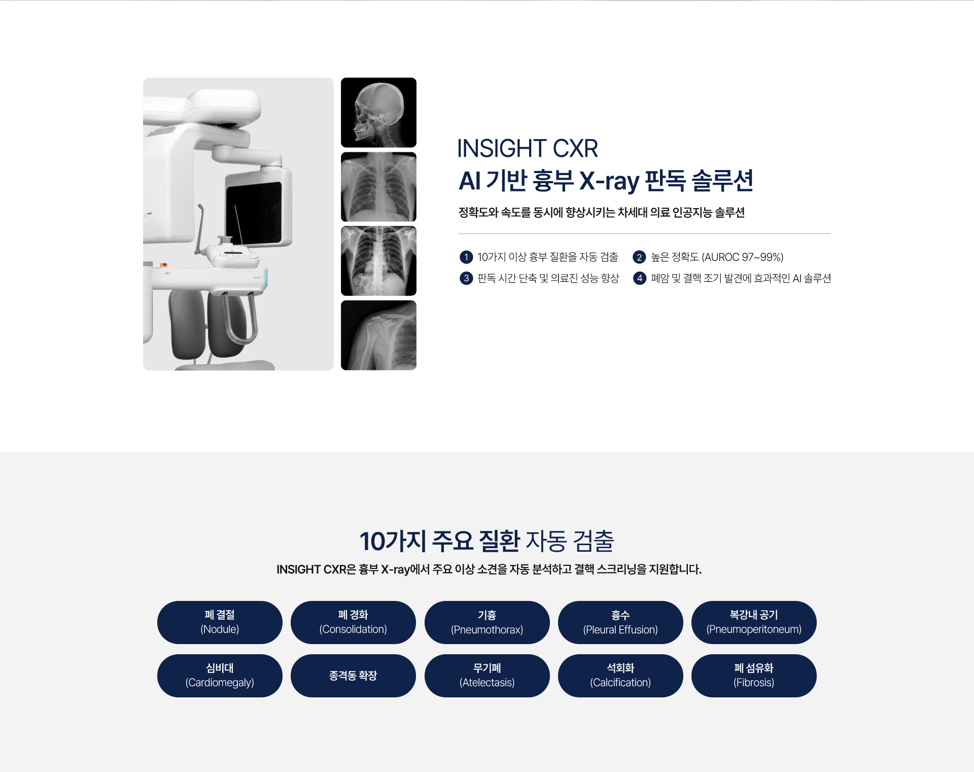 제노레이 흉부 X-ray